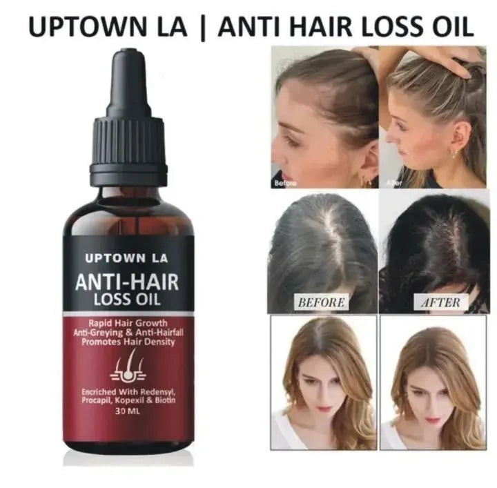 Anti Hair Loss Hair Growth Oil 30ml for Men & Women | Strengthening Scalp Serum