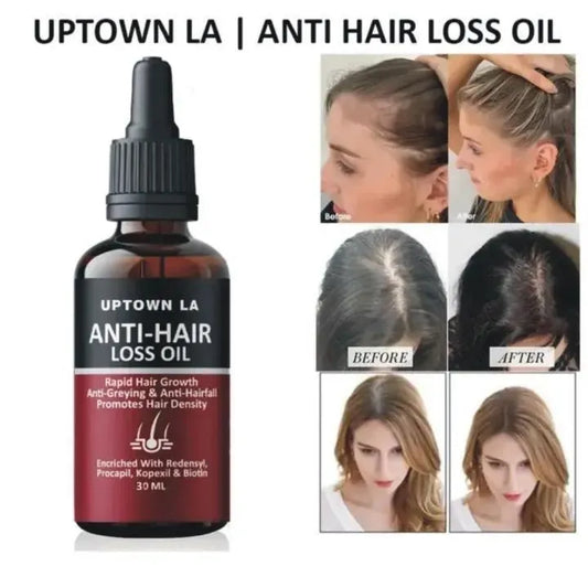 Anti Hair Loss Hair Growth Oil 30ml for Men & Women | Strengthening Scalp Serum